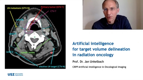 Thumbnail for AI for radiotherapy target volume definition