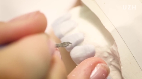 Thumbnail for Zahnmedizin – Studieren in Zürich