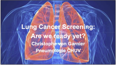 Thumbnail for Lungenkrebs-Screening: wer, wie, wann?