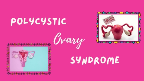 Thumbnail for Polycystic ovary syndrome (PCOS)