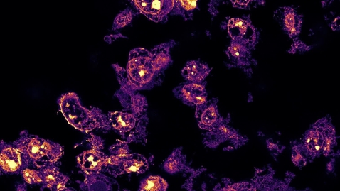 Thumbnail for Expansion microscopy fly-through - Glioblastoma, full protein staining