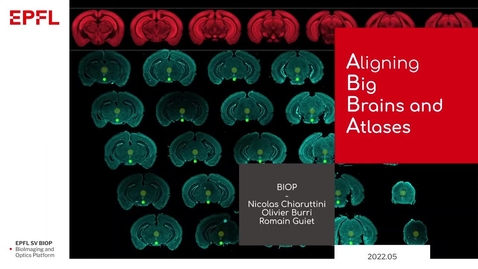 Thumbnail for Aligning Serial Brain Sections to the Allen Brain Atlas with ABBA